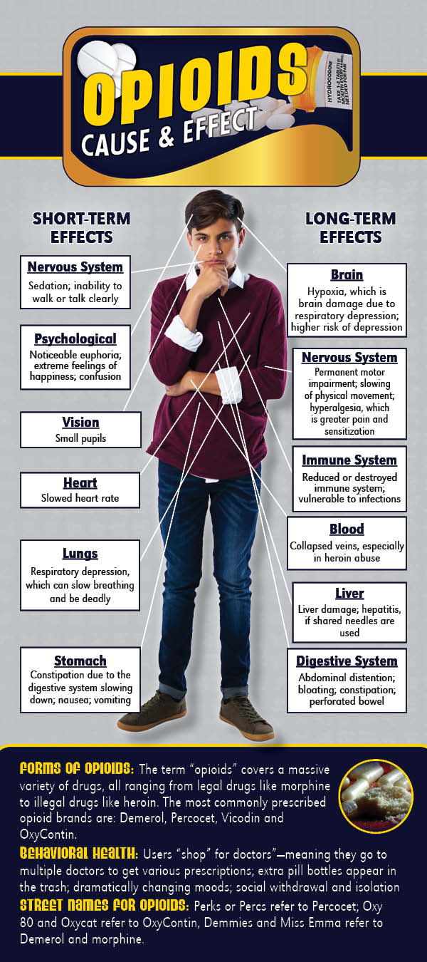RACK-CE-15 - Opioid Cause & Effect-FRONT C&E Opioids Prevention Retractable Banner Package - Image 4
