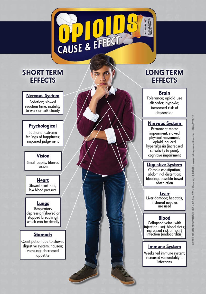 BAN-TTCE-15 Opioids Table Top Retractable Banner C&E Opioids - Image 2