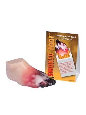 Smoked Foot Gangrene Model