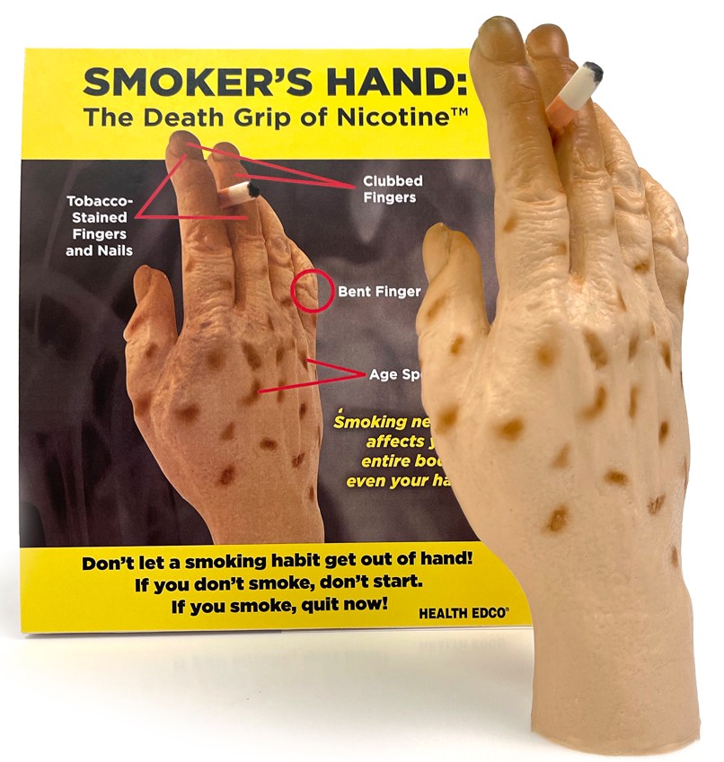27034-Smokers-Hand- SNIPPED Smoker's Hand: The Death Grip of Nicotine Model - Image 2
