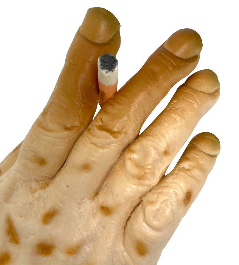 27034-Smokers-Hand-The-Death-Grip SNIPPED Smoker's Hand: The Death Grip of Nicotine Model - Image 3