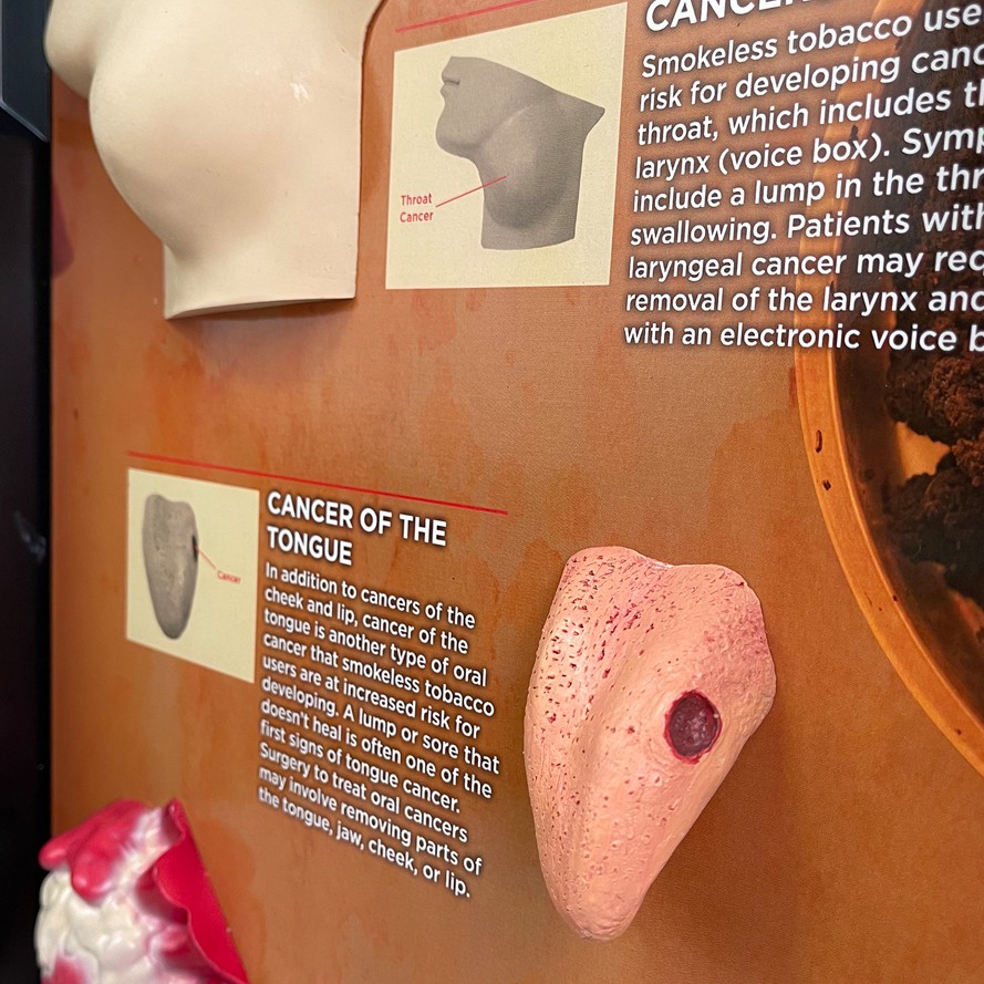 78817-Smokeless-Tobacco SNIPPED 2 Smokeless Tobacco Consequences 3-D Display - Image 3
