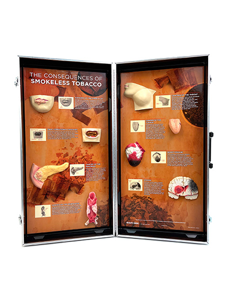 78817S~1 Smokeless Tobacco Consequences 3-D Display