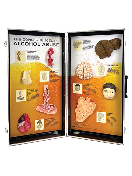 78879 Alcohol Abuse WEB FILE Alcohol Abuse Consequences 3-D Display