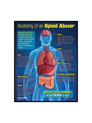 Anatomy of an Opioid Abuser 3-D Display