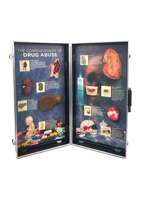 Drug Abuse Consequences 3-D Display