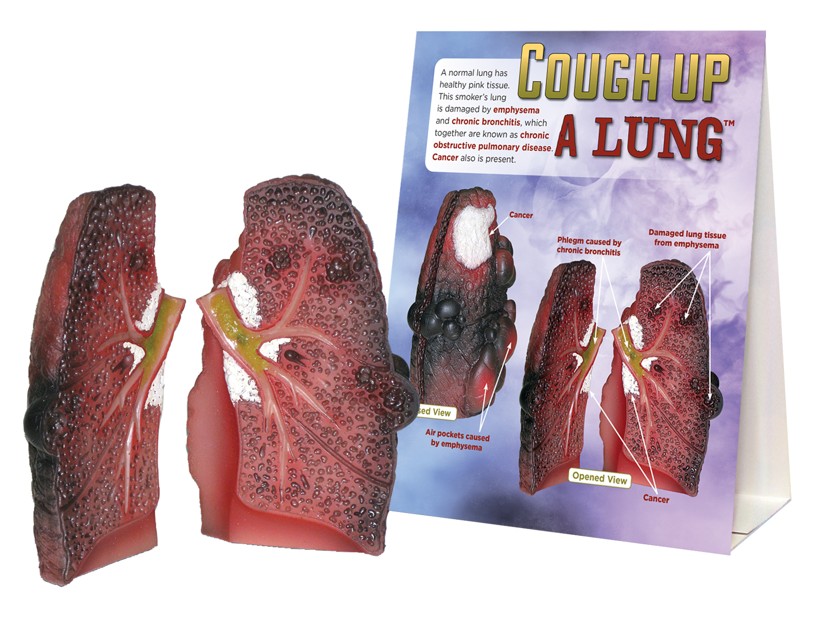 78958- WEB FILE SNIPPED Cough Up a Lung Model - Image 2