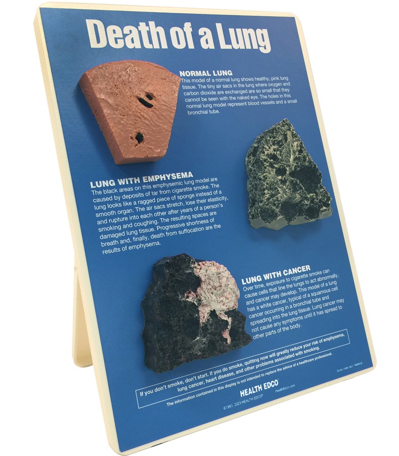 79148- NEED WEBSNIPPED Death of a Lung Easel Display - Image 2