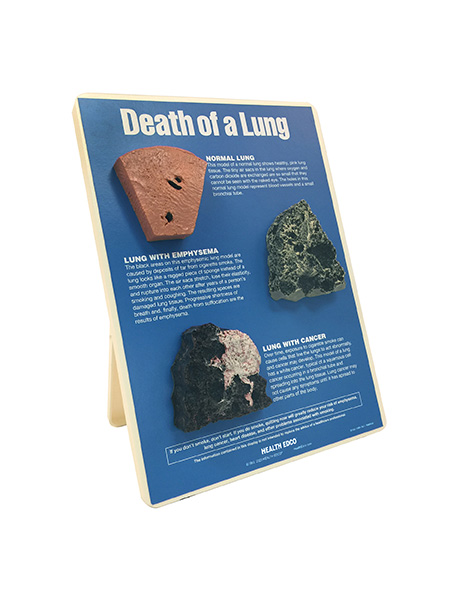 79148- WEB FILE Death of a Lung Easel Display