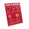 Death of an Artery Easel Display 79149 WEB FILE 100x100