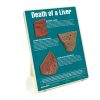 Death of a Liver Easel Display 79150 WEB FILE 100x100