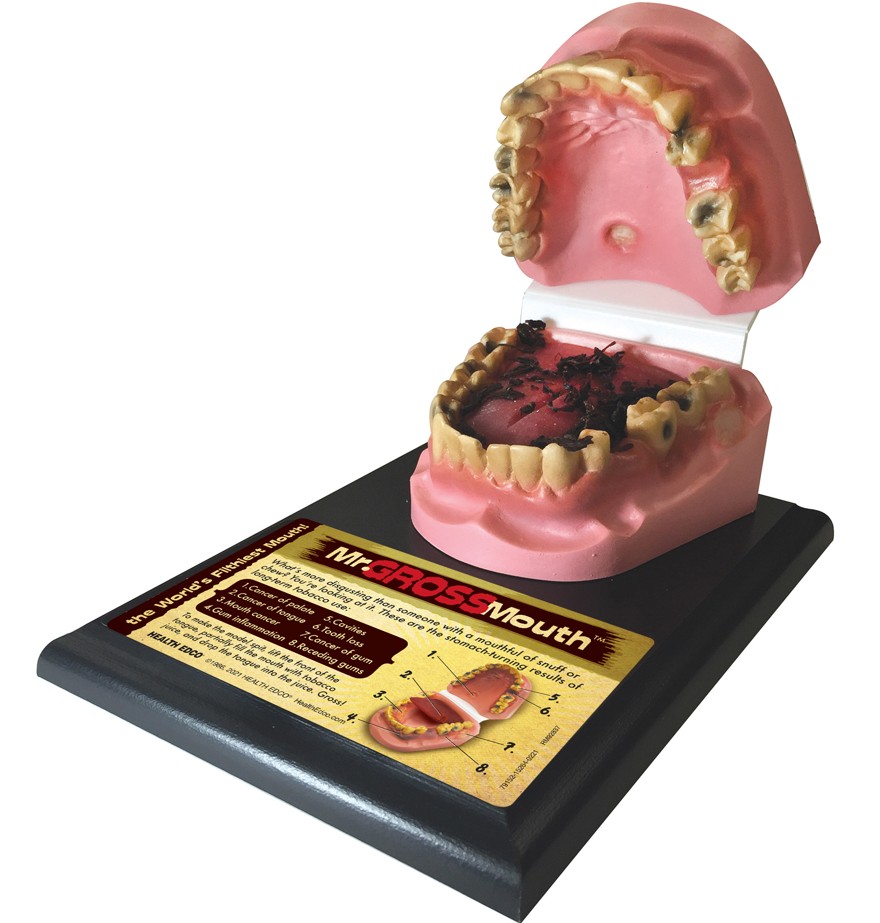 79152- NEED WEBSNIPPED Mr. Gross Mouth Model - Image 2
