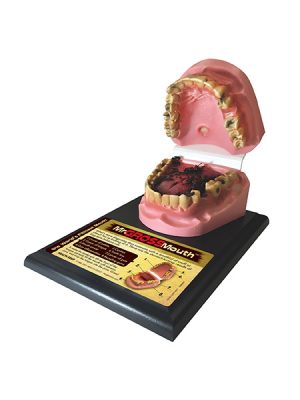 Mr. Gross Mouth Model