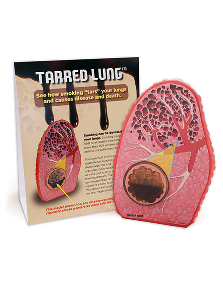 79234 WEB FILE Tarred Lung Model