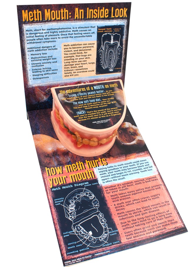 79758- NEED WEBSNIPPED 2 Meth Mouth: An Inside Look Display - Image 3