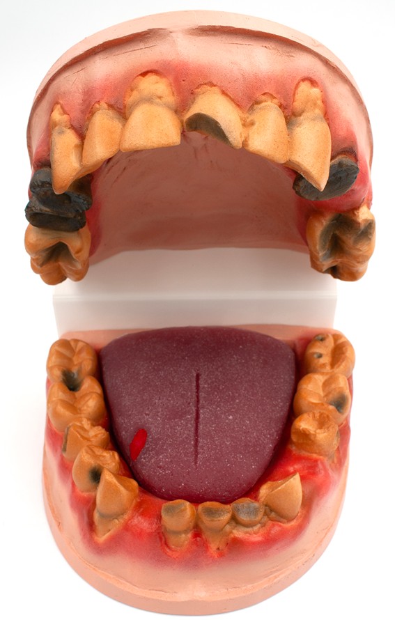 79758- NEED WEBSNIPPED 4 Meth Mouth: An Inside Look Display - Image 5