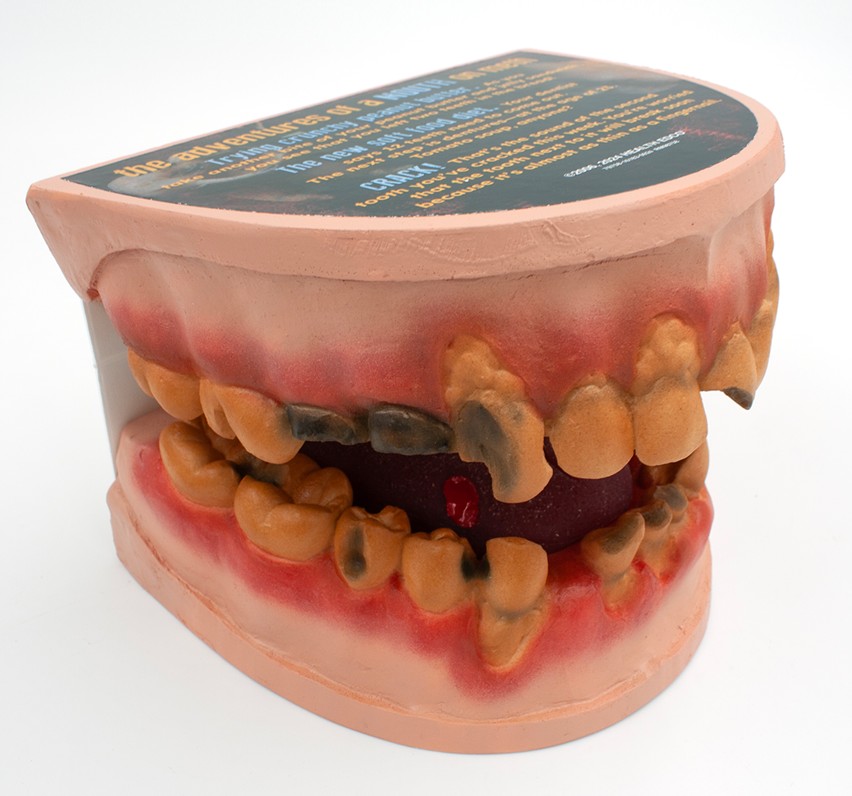 79758- NEED WEBSNIPPED 5 Meth Mouth: An Inside Look Display - Image 6