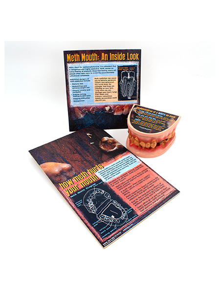 79758 WEB FILE Meth Mouth: An Inside Look Display