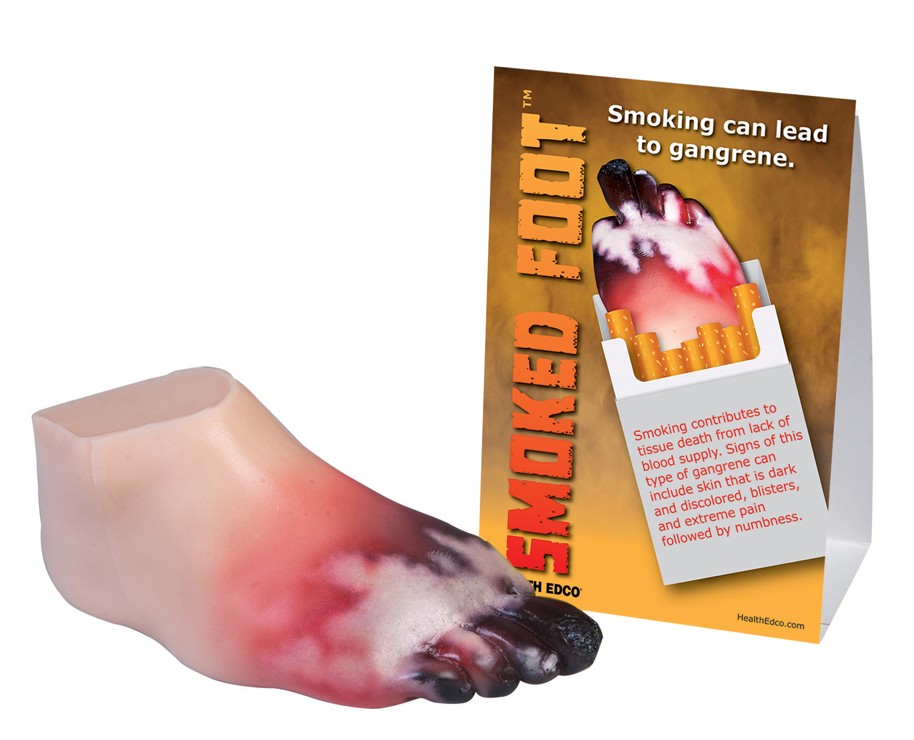 SNIPPED Smoked Foot Gangrene Model - Image 2