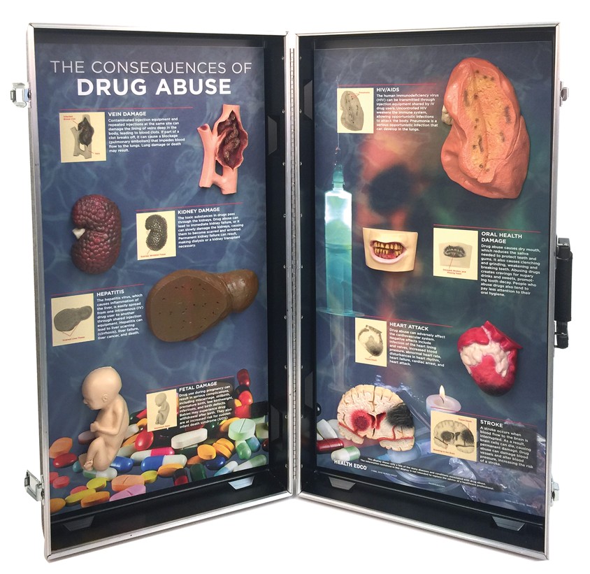 Screenshot 2025-12-08 SNIPPED Drug Abuse Consequences 3-D Display - Image 2