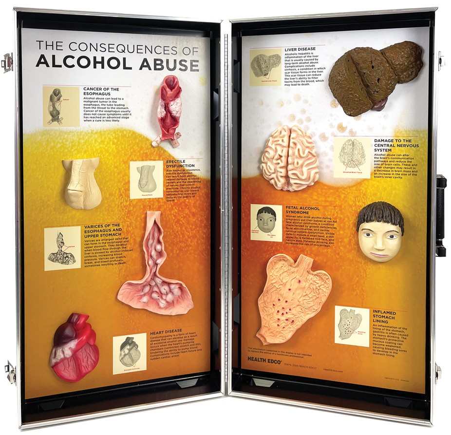 Screenshot 2025-12-08 SNIPPED Alcohol Abuse Consequences 3-D Display - Image 2