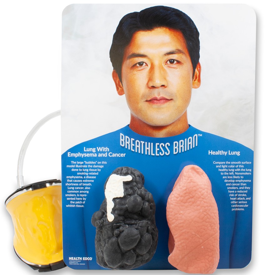 79556-Breathless-Brian-Smokers-Lungs SNIPPED Breathless Brian Smoker's Lungs Comparison Model